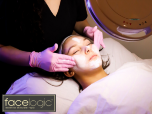 Acne Facials with Facelogic Dallas