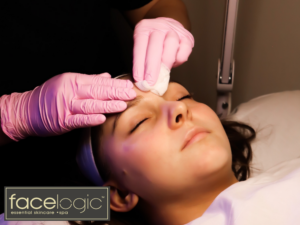 Enzyme Peels with Facelogic Dallas