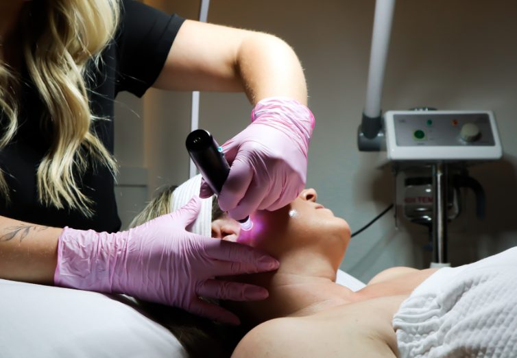 Nano Micro Needling